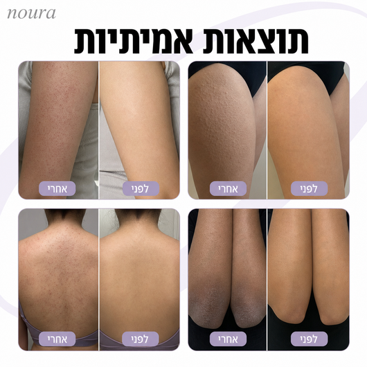 NOURA KP - סקראב גוף להחלקת עור אווז