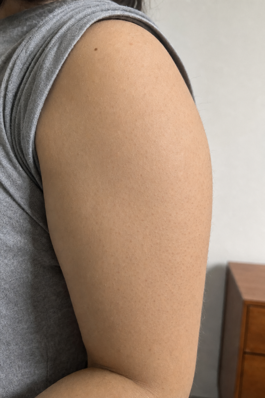 Illustration of the same upper arm with smoother-looking skin