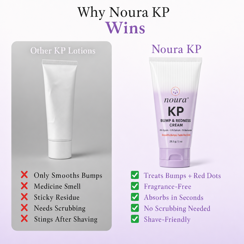 Comparison chart of a plain white KP lotion tube and the Noura KP Bump & Redness Cream tube
