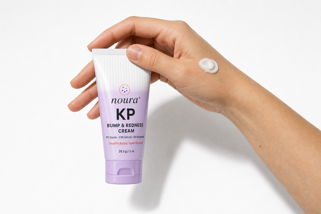 Hand holding a tube of Noura KP Bump & Redness Cream