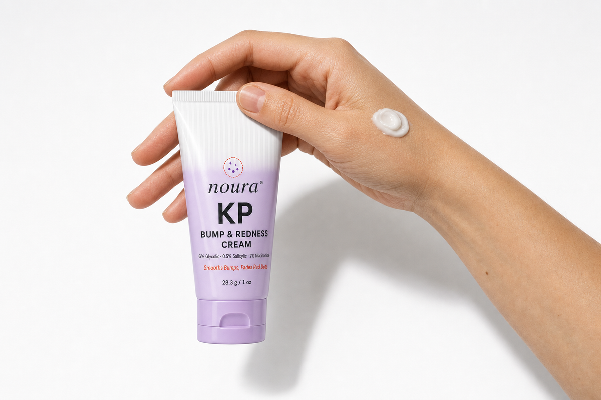 Hand holding a tube of Noura KP cream with a dab of the cream on the back of the hand