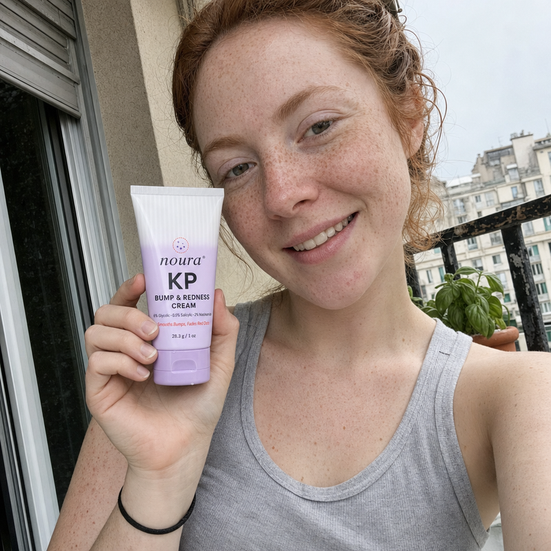 Woman with red hair smiling on a balcony and holding a tube of Noura cream