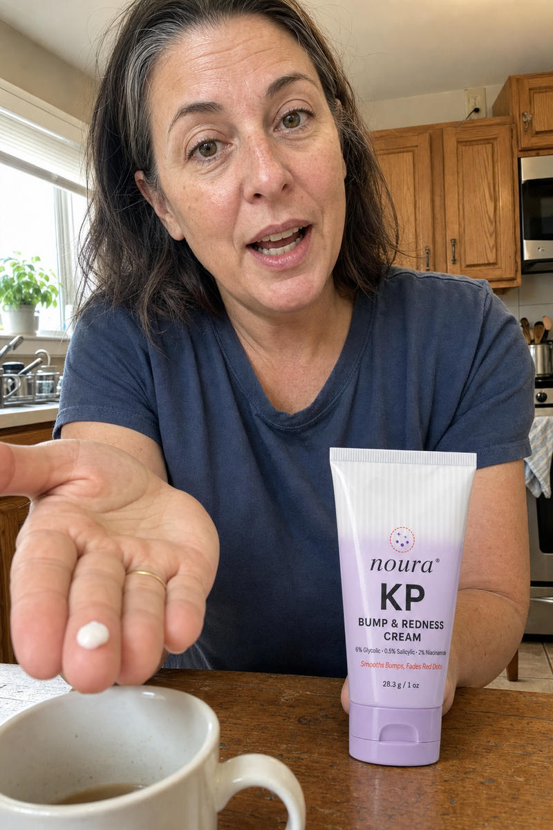 Woman at her kitchen table showing a small dab of Noura KP cream on her fingertip