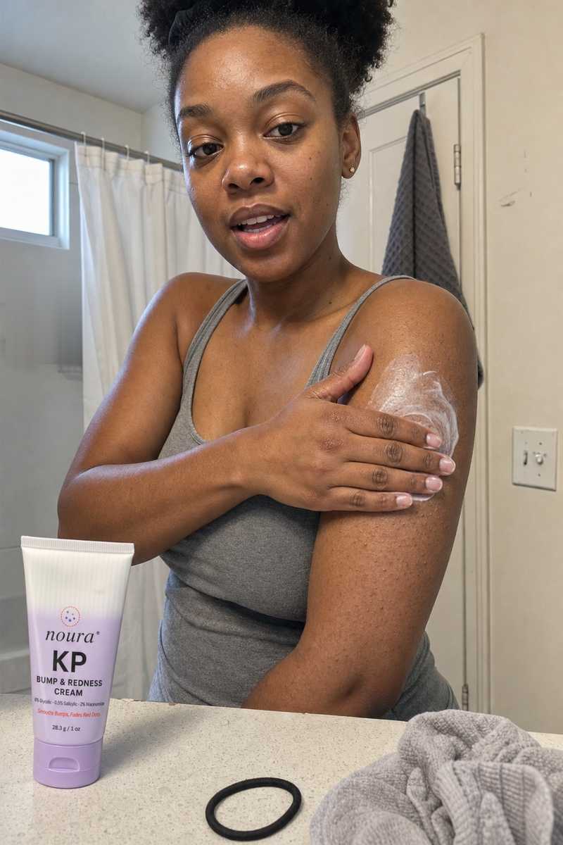 Woman in a gray tank top rubbing Noura KP cream into her upper arm